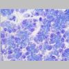 Pancreas SF 09.jpg
